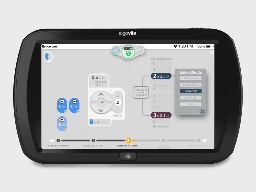 directSTIM DBS clinician programmer screen on the Algovita tablet, showing benefit and side-effect scoring